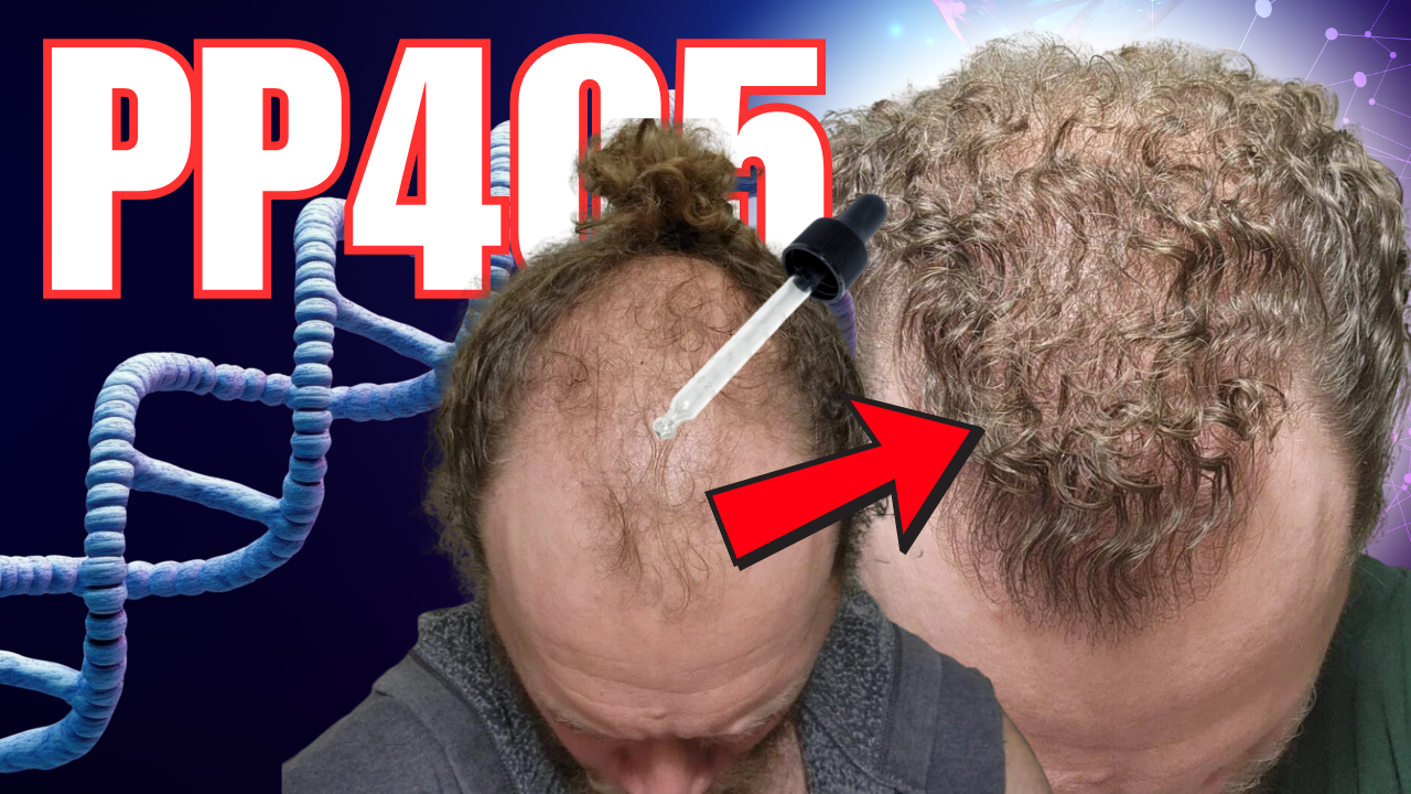 PP405 Trials Show Promising Results for Full Hair Regrowth